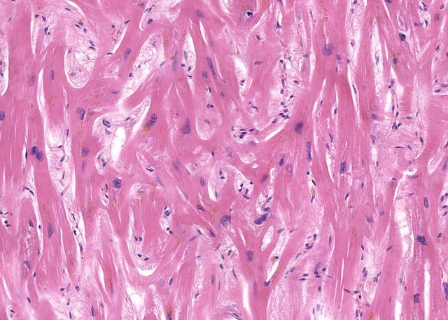 HCOM histology