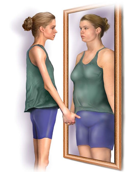 Anorexic patients often have distorted body images (source)