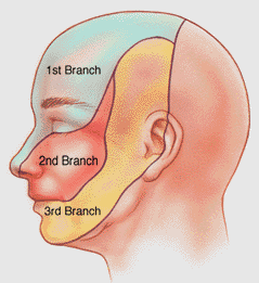 Anatomical territories of the trigeminal nerve branches (source)