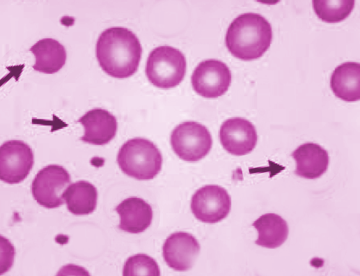 Degmacytes (source) 