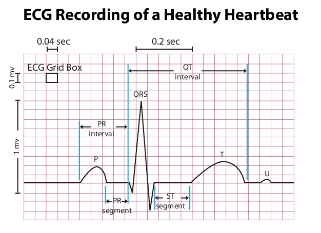 EKG intervals 