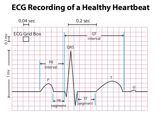 EKG intervals