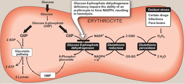 Glucose 6 Phosphate Dehydrogenase G6pd Deficiency Stepwards