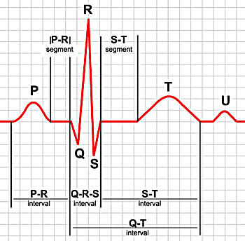 General EKG image