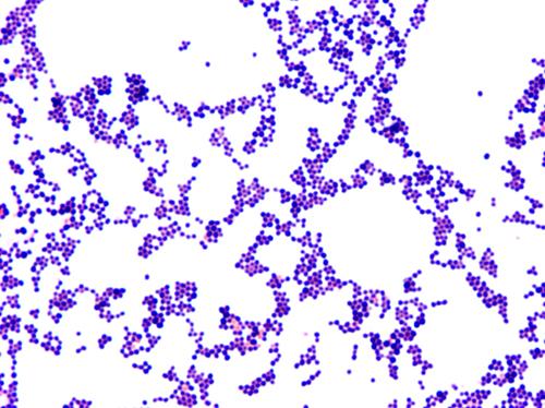 Staphylococcus aureus seen under microscope after Gram's staining