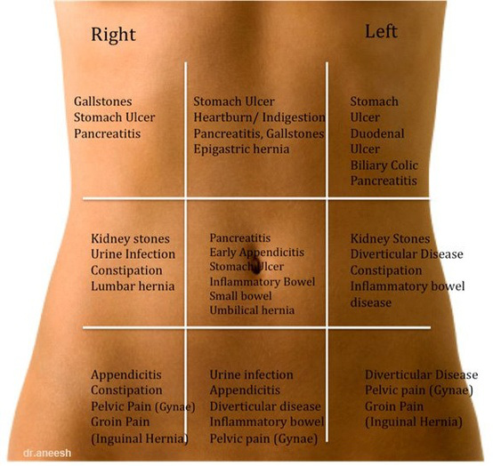 General reference for causes of abdominal pain in specific locations (source)