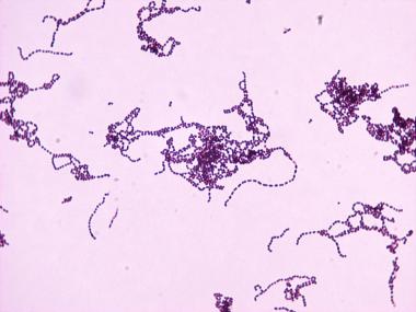 Gram stain of S. pyogenes (source)