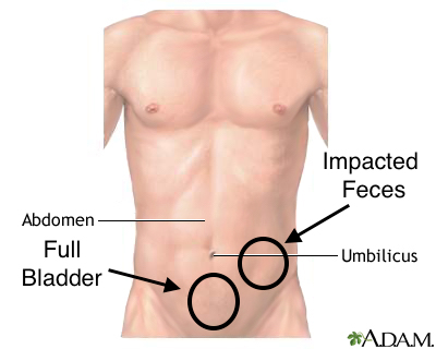 Possible locations of findings from deep palpation (source)