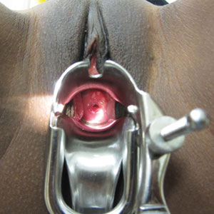 Visualization of cervix using a speculum (source) 