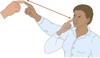 Schematic of nose to finger test (source)