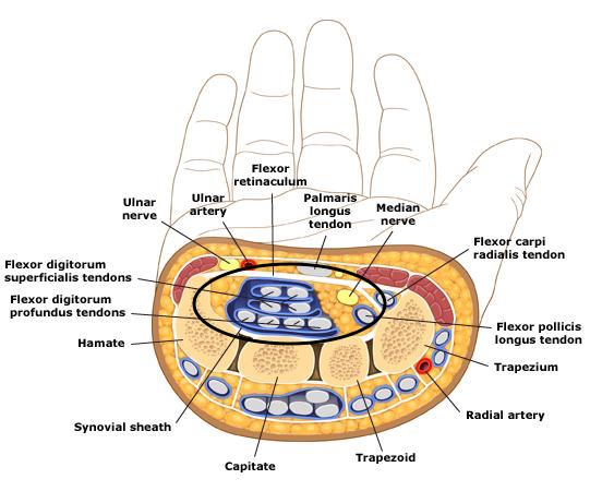 Carpal Tunnel Release Stepwards