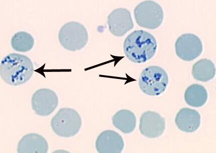Appearance of reticulocytes stained with methylene blue (source)