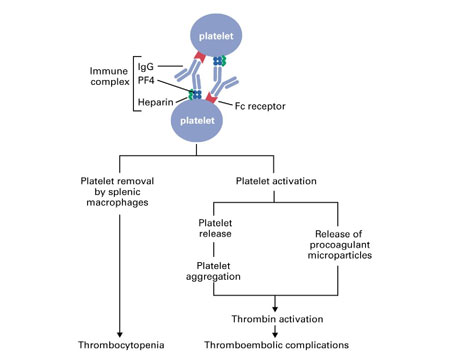 General mechanism of heparin induced thrombocytopenia (source)