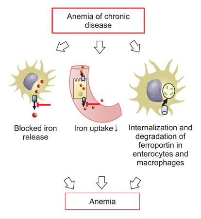 anemia of chronic disease)