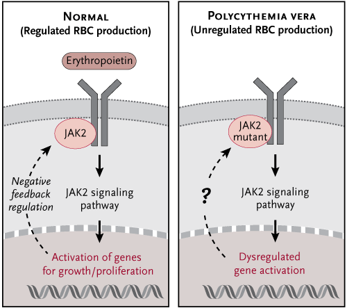 Normal vs. JAK2 mutant signaling observed in PCV (source)