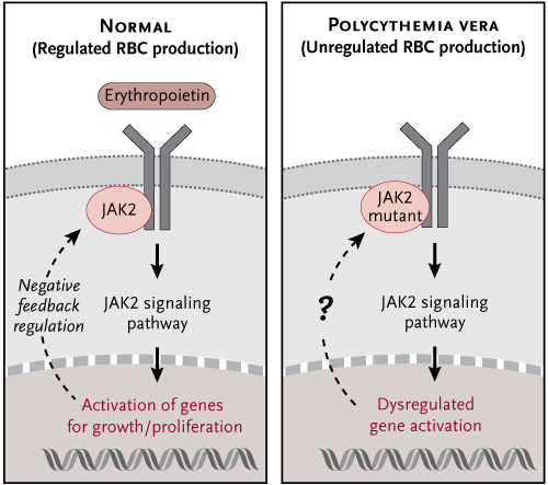 polycythemia vera