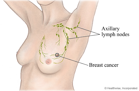 Anatomy of axillary lymph nodes (source) 
