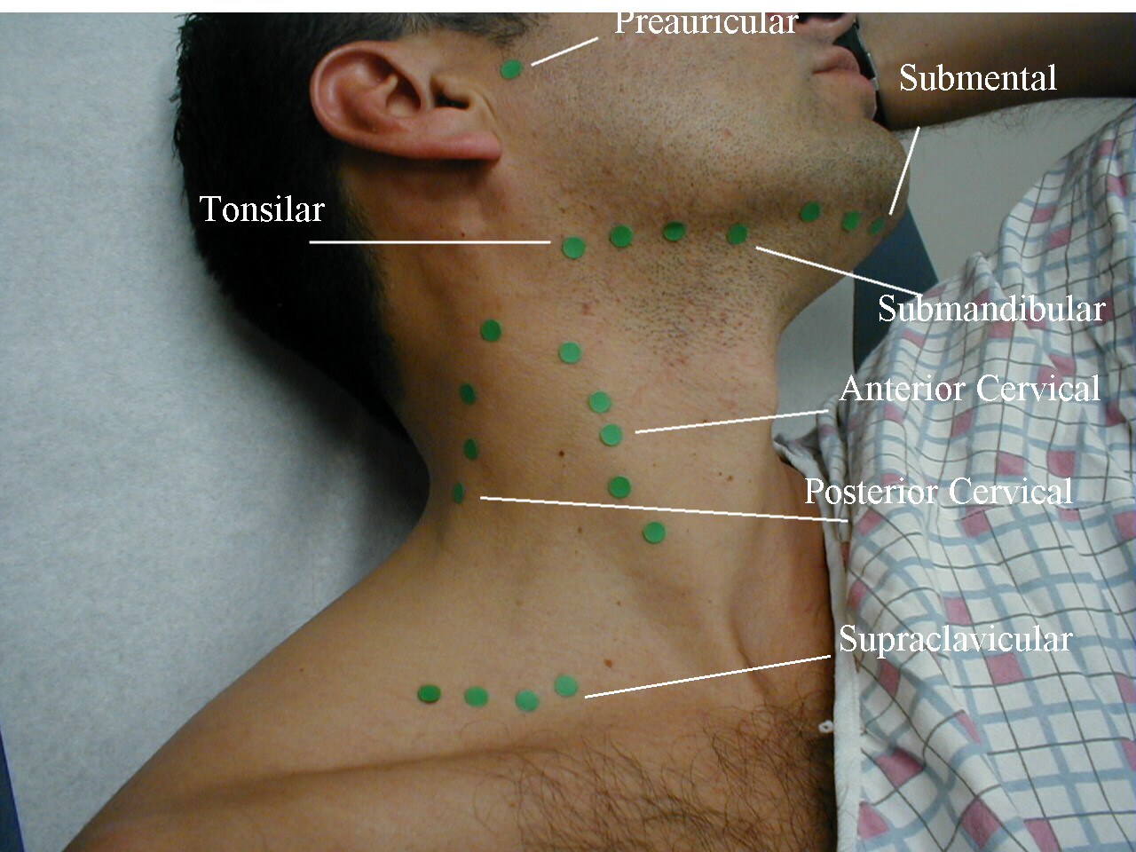 Palpation locations of the lymph nodes in the head and neck (source)