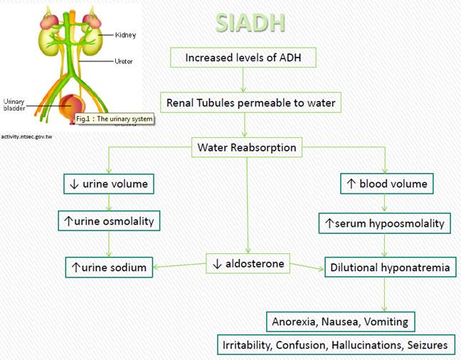 Pathophysiology of SIADH (source) 