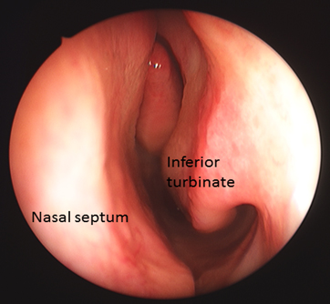 Anatomy of the nasal canal (source)