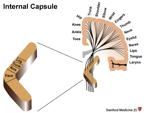 Motor pathways from the cerebral hemispheres travel together down through a structure in the brain called the internal capsule. In this structure the motor pathways all are in close proximity and single lesion can affect them all (source) 