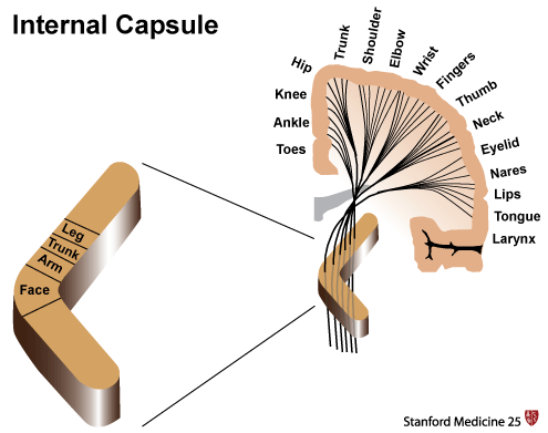 Motor pathways from the cerebral hemispheres travel together down through a structure in the brain called the internal capsule. In this structure the motor pathways all are in close proximity and single lesion can affect them all (source)