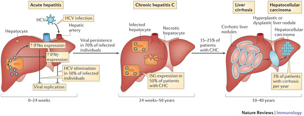 Pathophysiology of hepatitis C/HCV infection (source) 