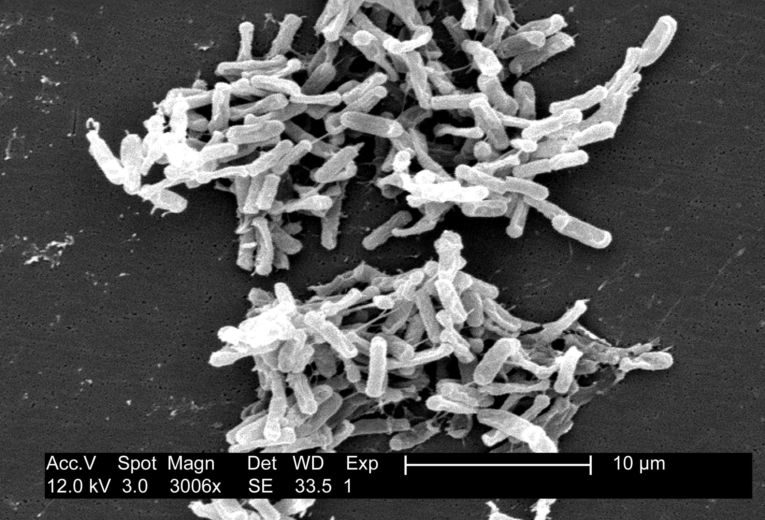 Electron micrograph of Clostridium difficile (source) 