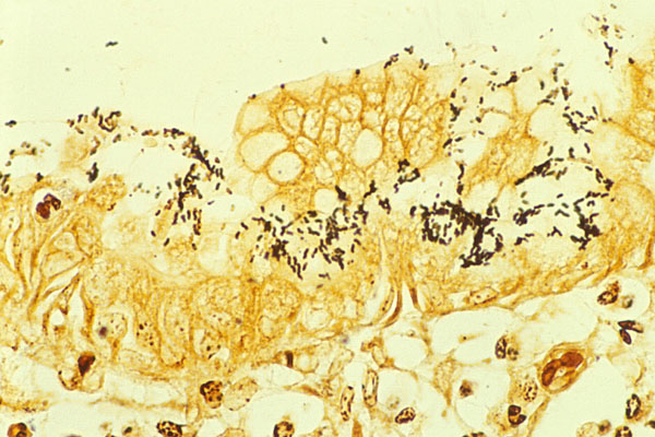 Silver stain of H. pylori on epithelial cells (source)