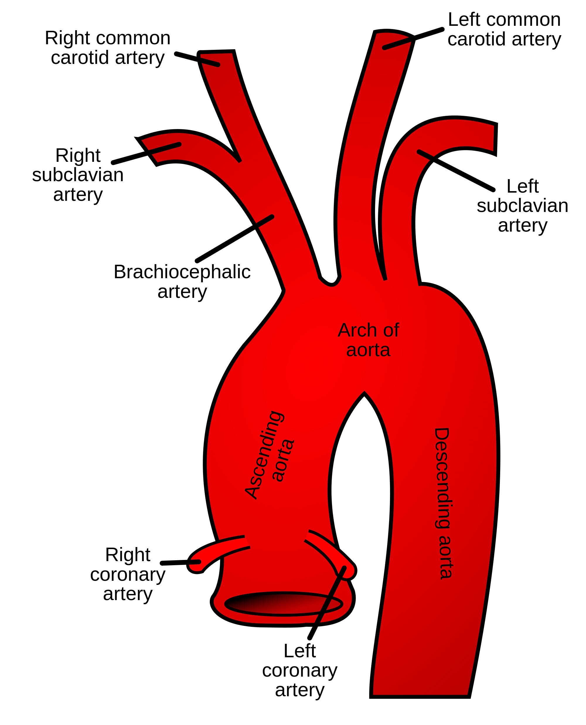 Initial branches of the aorta (source) 