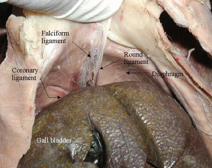 Anatomical location of falciform ligament (and other associated structures, source)