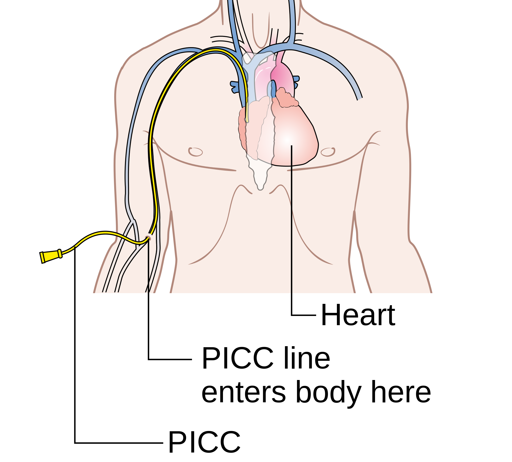 How To Take Care Of A Picc Line How To Take Care Of A Picc Line
