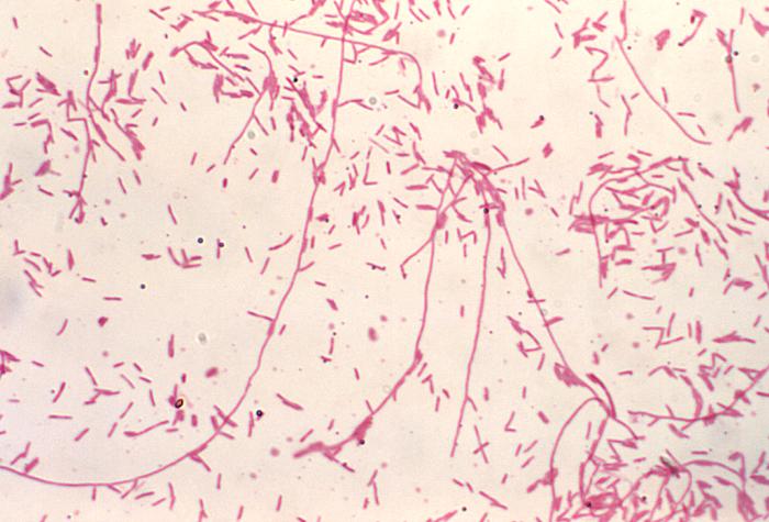 Gram stain of Legionella pnumophillia (source)