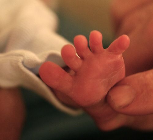 Babinksi sign in a newborn (source)