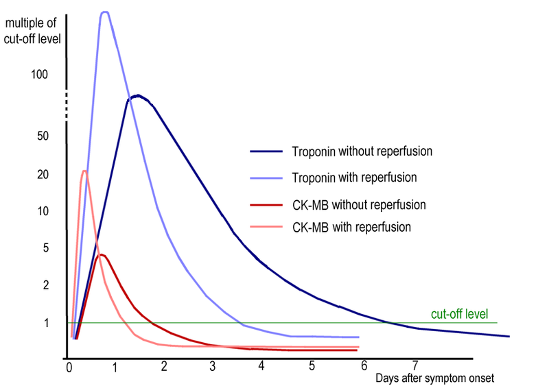 Timeline of elevated troponin I levels, with and without re-profusion (source) 