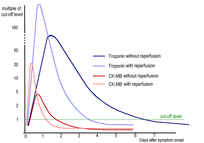 Timeline of elevated troponin I levels, with and without re-profusion (source)