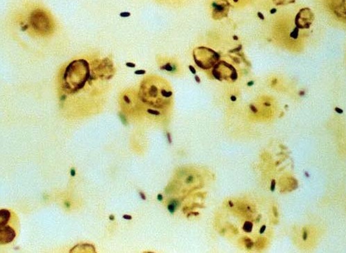 Visual appearance of intracellular Legionella pneumophillia bacterium using a silver stain (source)