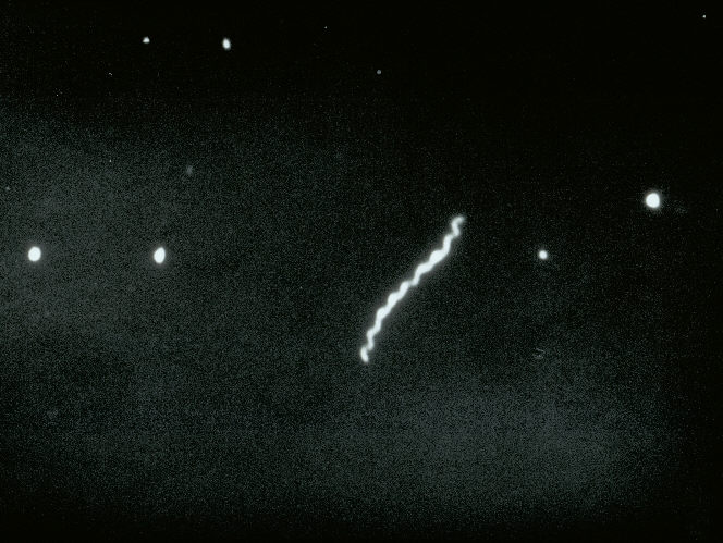 Visual appearance of Treponema palladium on dark field microscopy (source) 