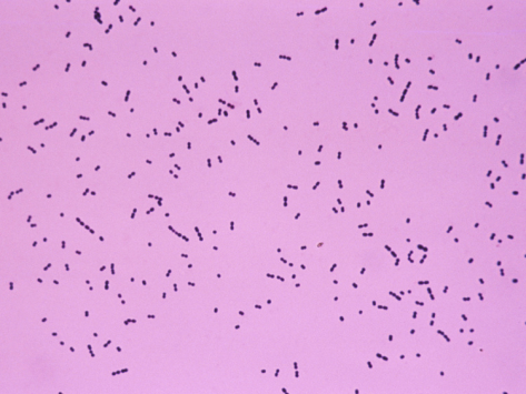 Gram stain of strep pneumo (source) 