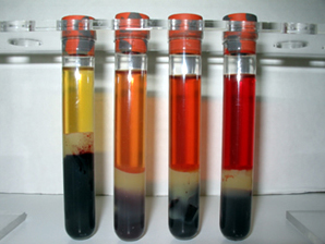 Spun down blood from patients. The tube on the most left side of the picture has a greater hematocrit level then the rest (source) 