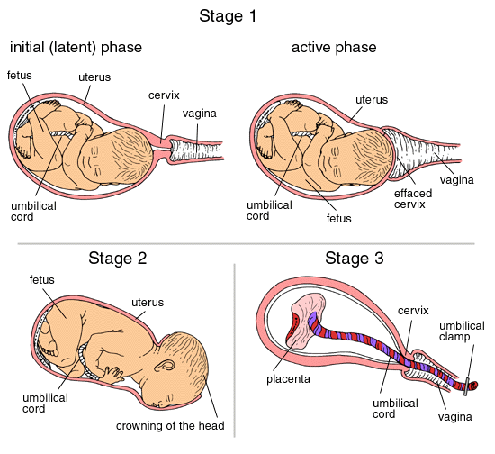Brief characterization of the different stages of delivery (source)