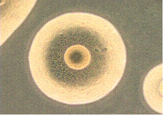 "Fried egg" appearance of mycoplasma colony that is characteristic of this pathogen (source)