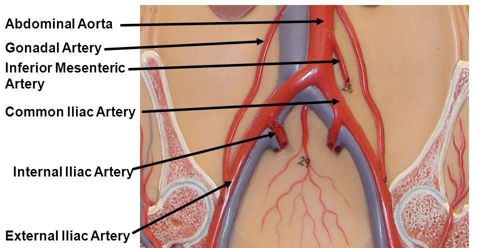 Anatomy of external iliac artery (source) 