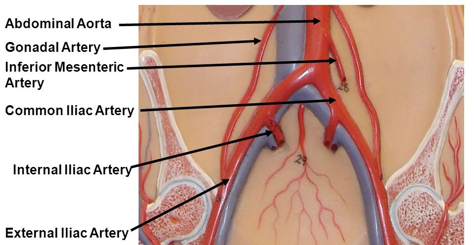 right common iliac artery