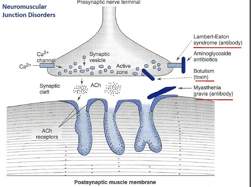 Lambert-Eaton is just one of a few different NMJ disorders (source) 