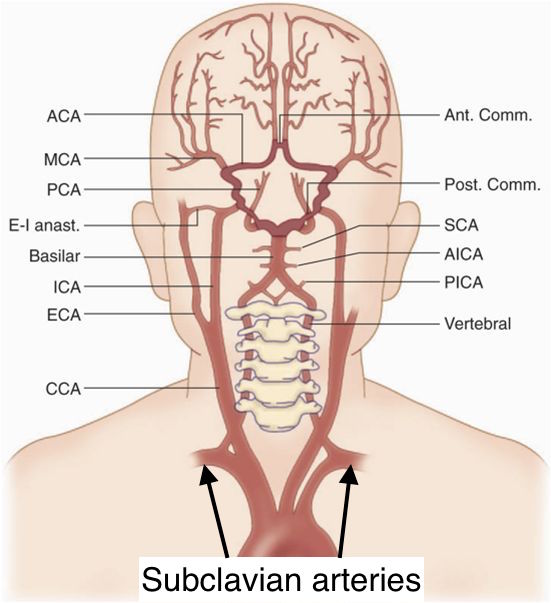Anatomical location of the vertebral arteries (source) 