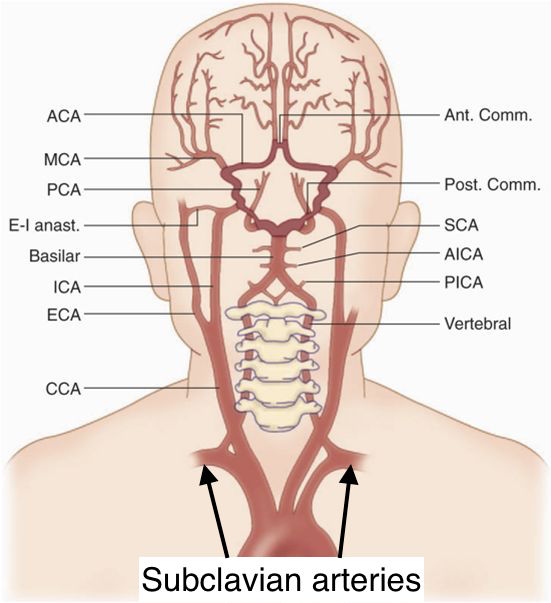 vertebral artery