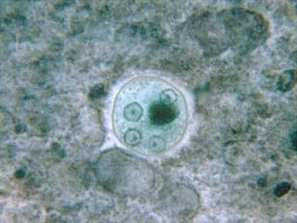 Entamoeba histolytica cyst containing 4 nuclei (source)