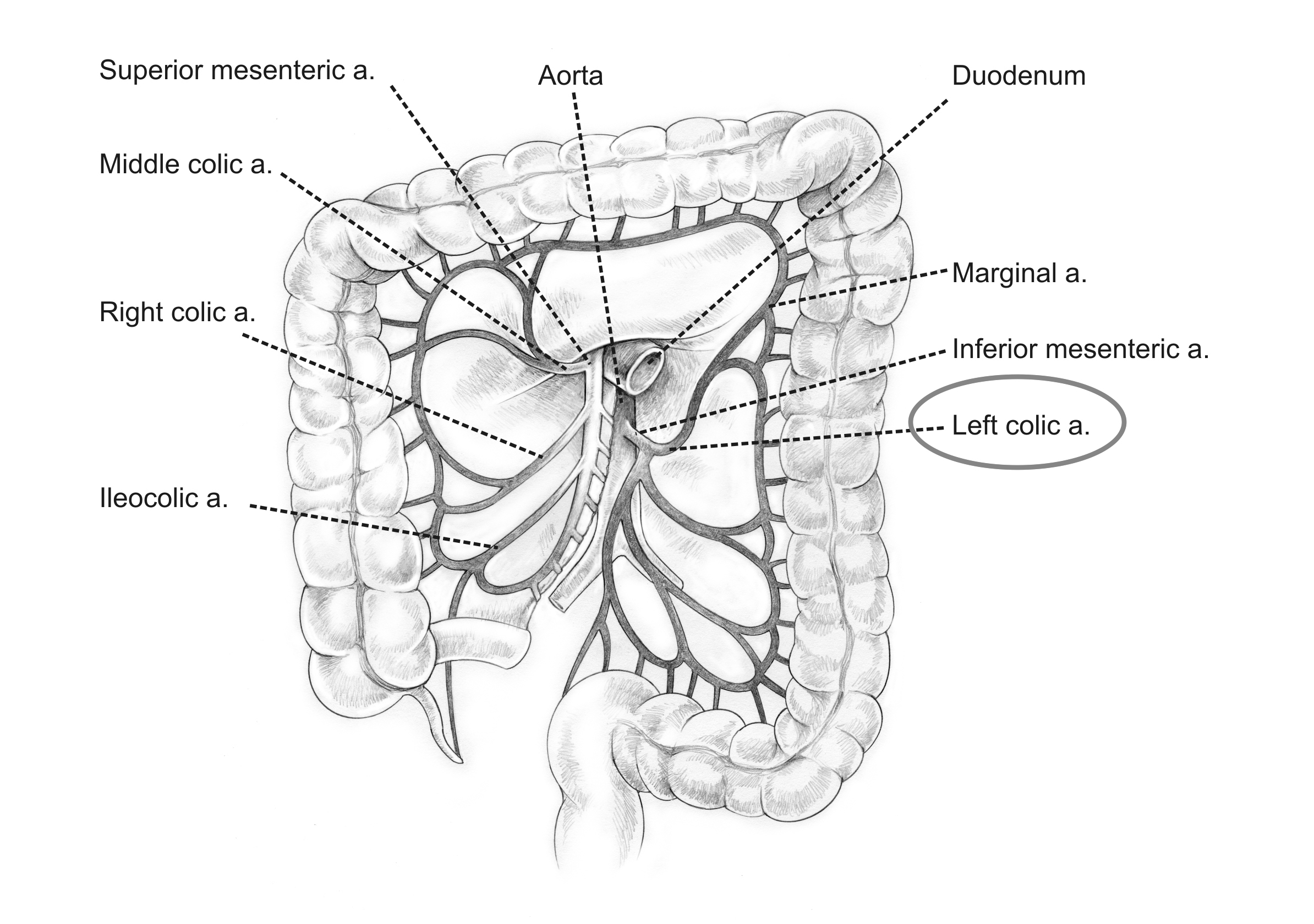 Anatomical location of the left colic artery (source)