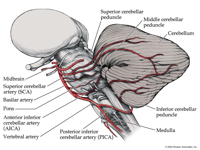 posterior-inferior-cerebral-artery-pica-stepwards
